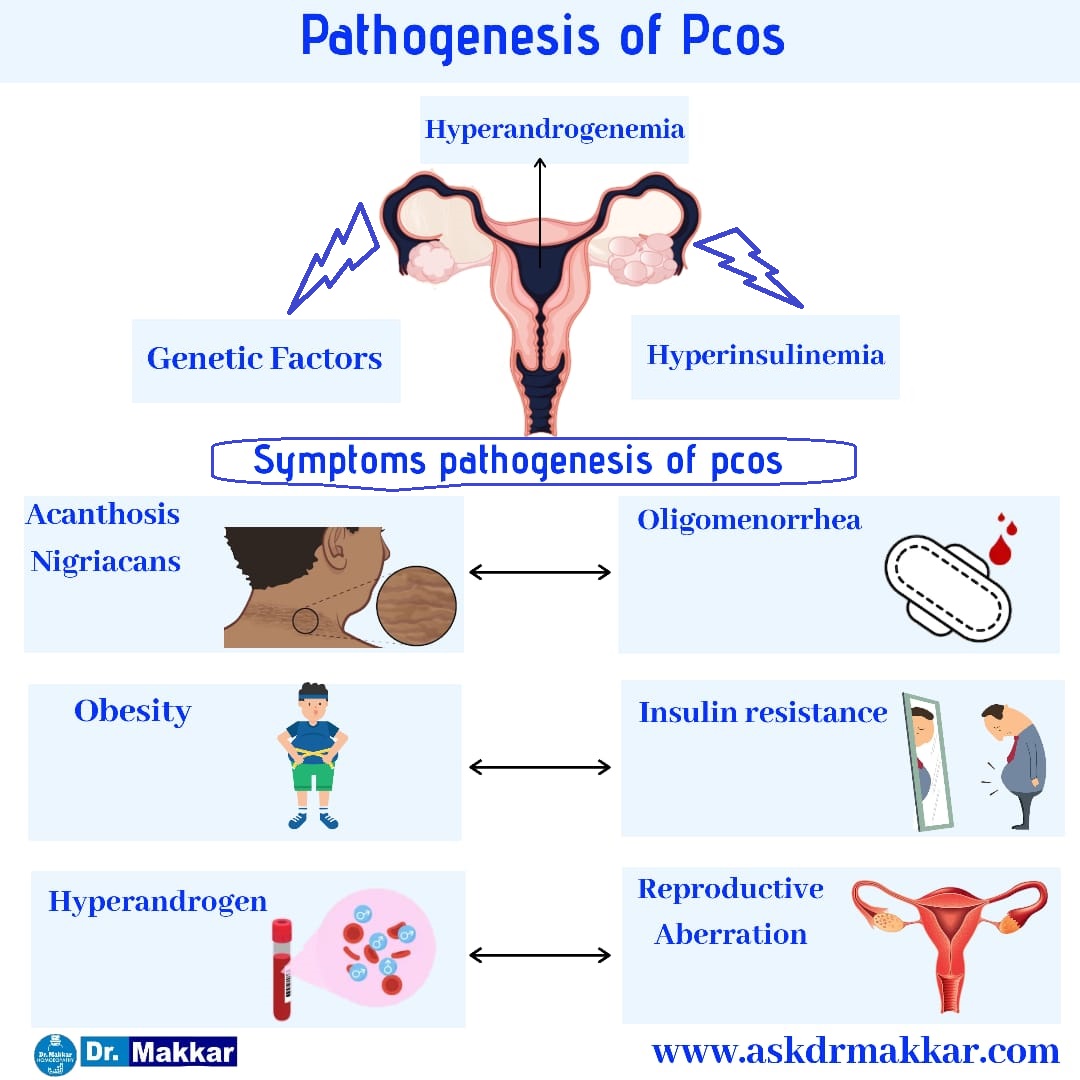 Pcos syndrome что это